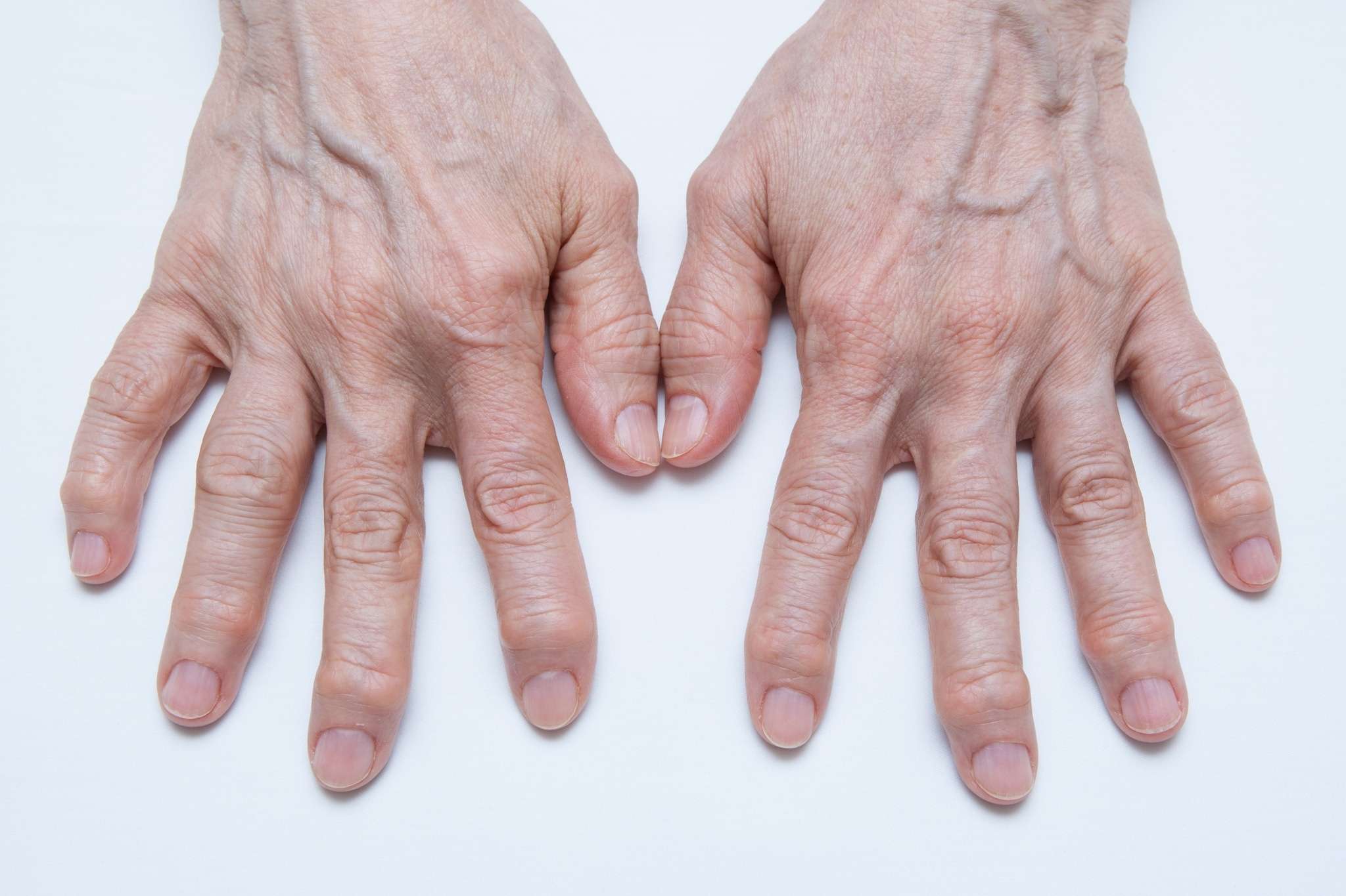 An elderly person's hands on a table.